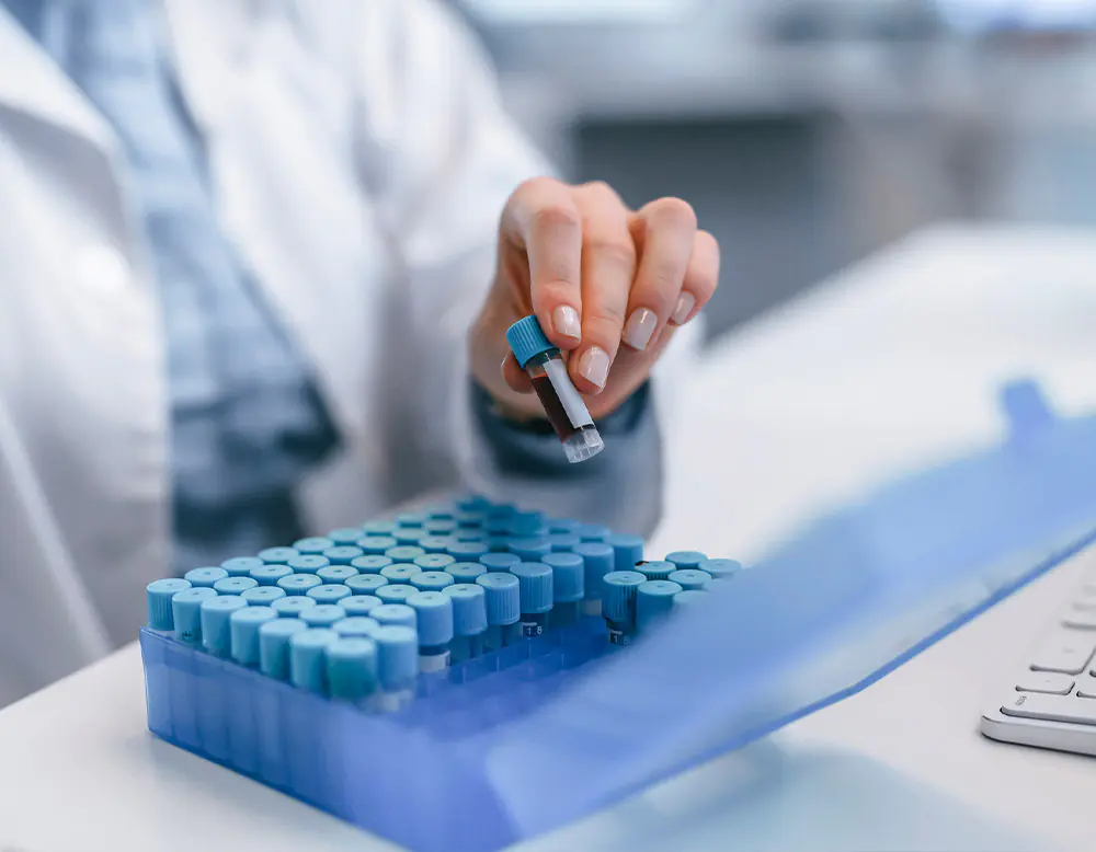 my labs direct precision trusted at home health tests